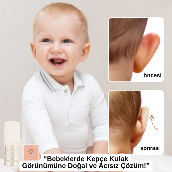 EARLEPS™ Kulak Bandı (20 Adet 3-4 Ay Kullanım İçin Uygun)