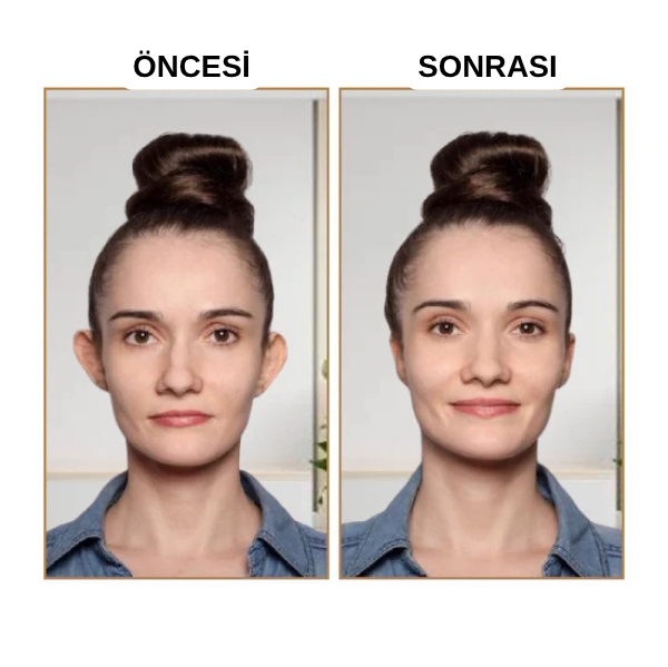 EARLEPS™ Kulak Bandı (20 Adet 3-4 Ay Kullanım İçin Uygun)