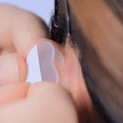 EARLEPS™ Kulak Bandı (20 Adet 3-4 Ay Kullanım İçin Uygun)